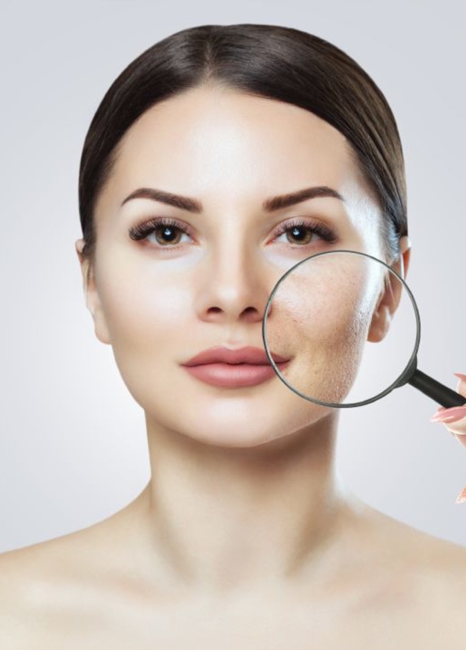 كيفية التخلص من مسامات الوجه نهائياً بالطرق الطبيعية