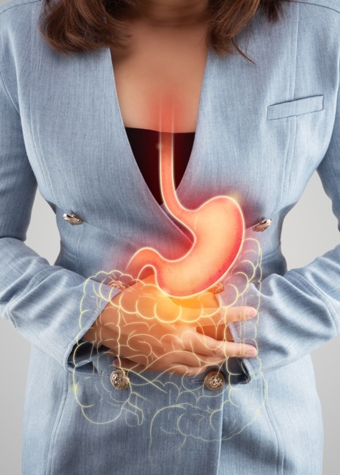 كل ما تحتاجين معرفته عن الإرتجاع المعدي المريئي