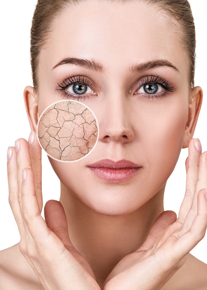 نصائح وطرق طبيعية لتنظيف البشرة الجافة