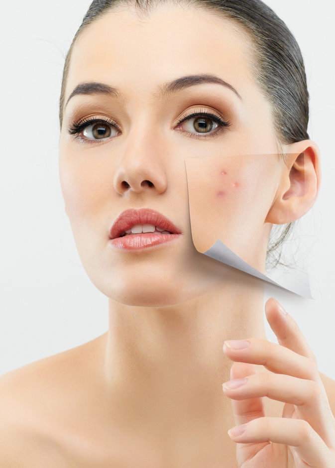 خلطات طبيعية فعّالة ومجربه للبشرة الدهنية المعرضة لحب الشباب