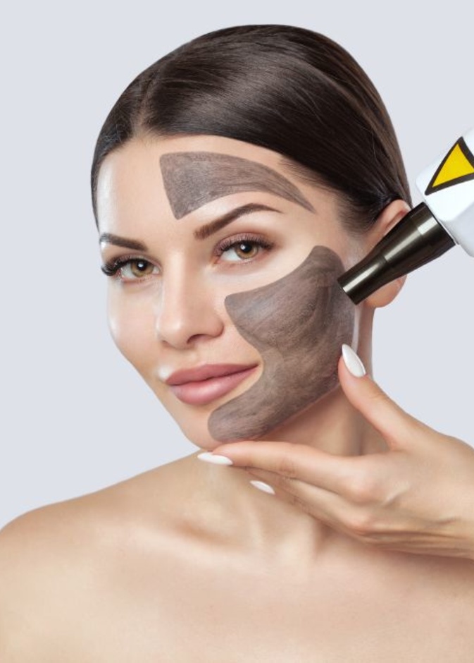 فوائد الليزر الكربوني لبشرة نضرة في يوم عيد الأم