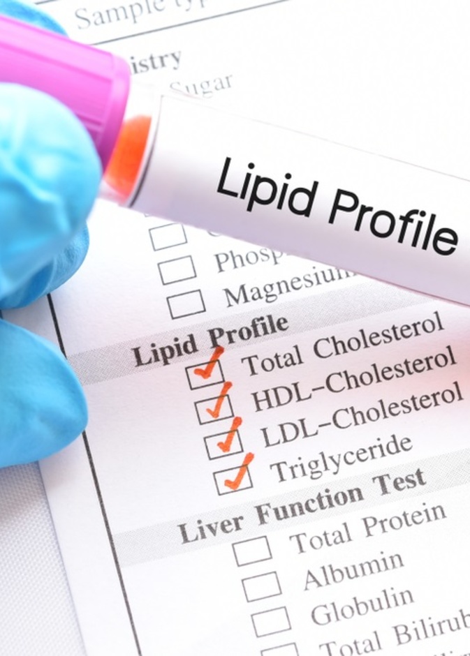 ما هو فرط شحميات الدم وكيف يمكن الوقاية منه