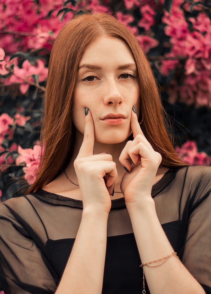 مميزات حقن فيلر الخدود وماهي تقنياته وأفضل أنواعه