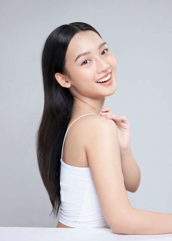 الصدفية مرض مناعي لا يمكن علاجه بالكامل