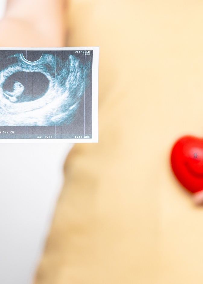 شكل الجنين في الأسبوع الخامس من الحمل