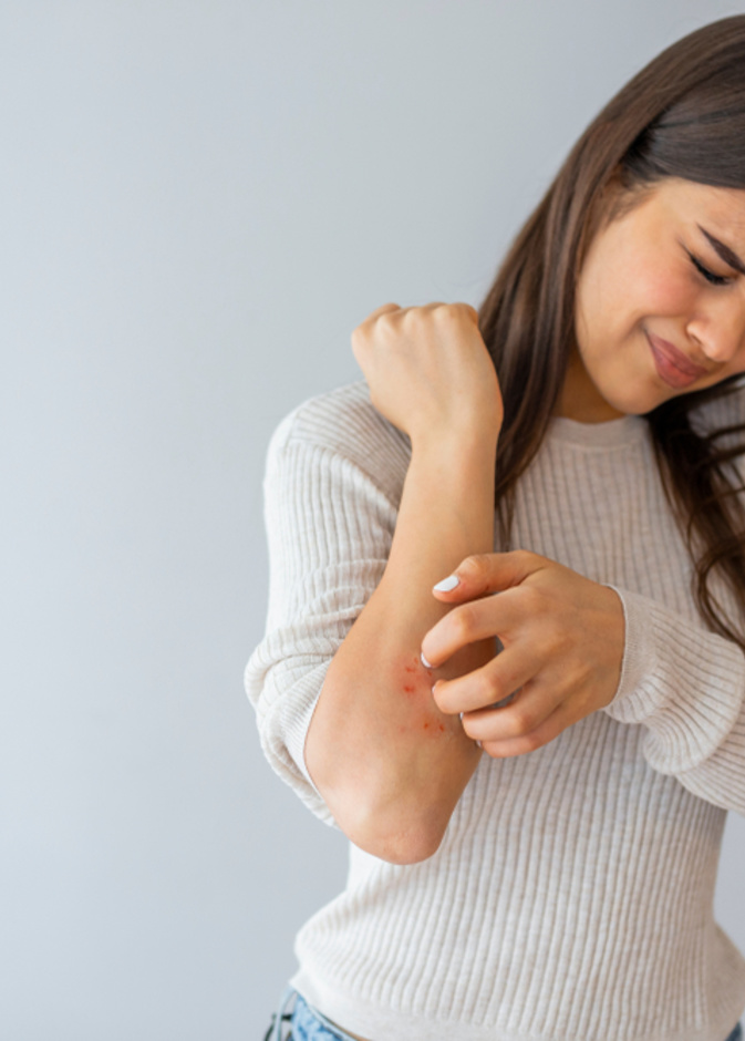 أعراض تدل على إصابتك بالتهاب الجلد التماسي