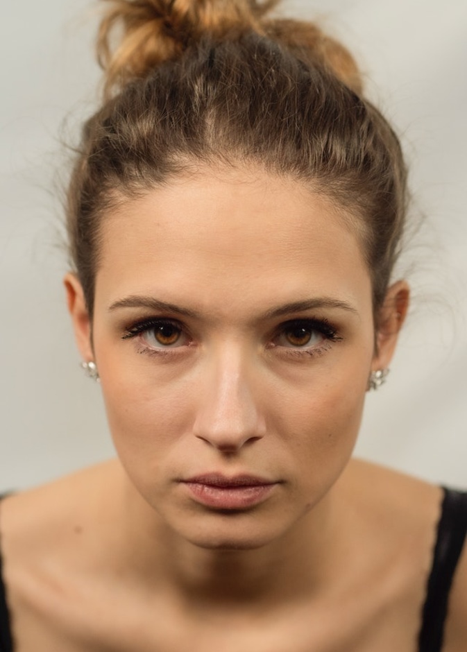 تعانين من الرؤوس السوداء في الأنف؟ إليك أفضل الطرق الطبيعية لإزالتها