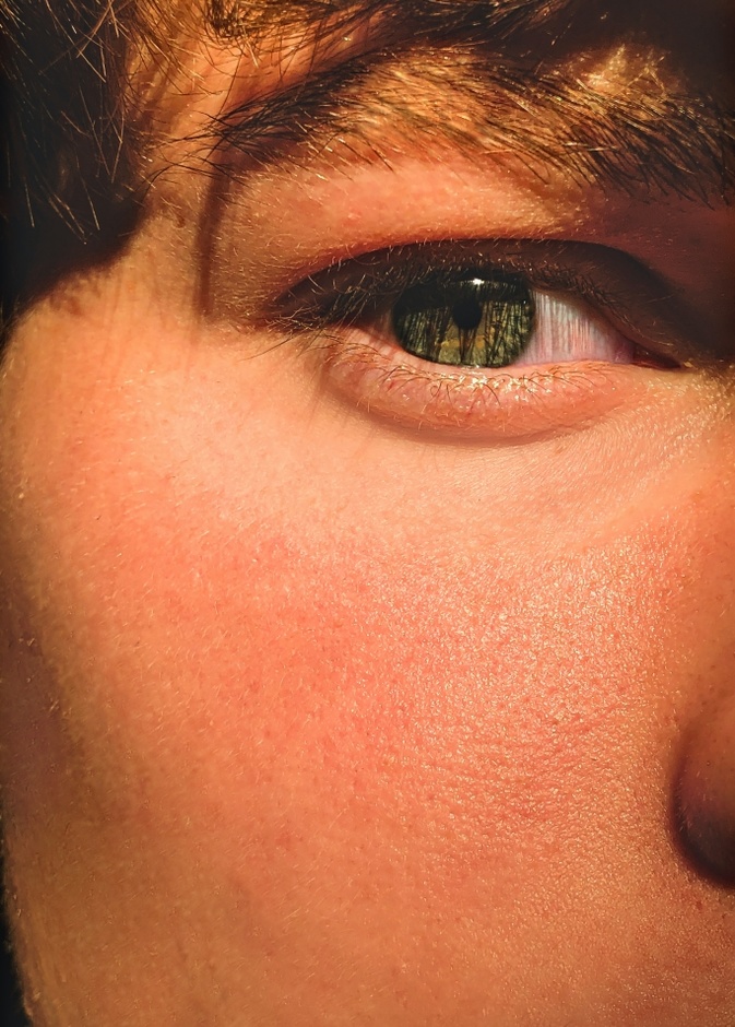 طريقة عمل ماسك اليار والبابونج مذهلة لعلاج الهالات السوداء في اسرع وقت