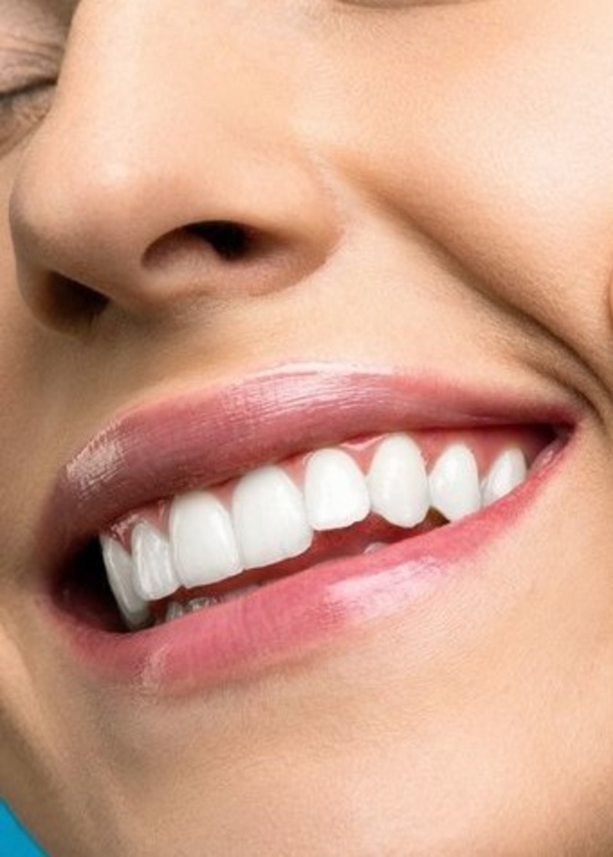 إحصلي على أسنان بيضاء قبل حلول عيد الأضحى بوصفات طبيعية سريعة