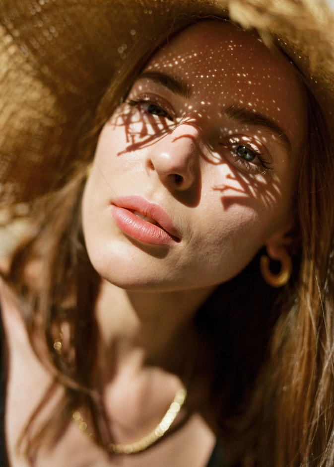 تُعانين من الإلتهابات الجلدية البكتيرية في فصل الصيف؟..إليكِ الأسباب وكيفية الوقاية منها