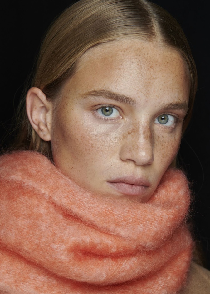 طرق إزالة النمش من الوجه مع بداية موسم الخريف