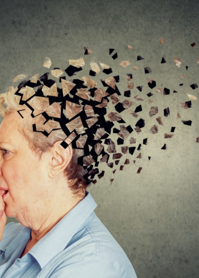 الزهايمر مرضٌ يعيق التفكير والذاكرة.. والتقنيات الحديثة تسعى لعلاجه بطرق فعالة