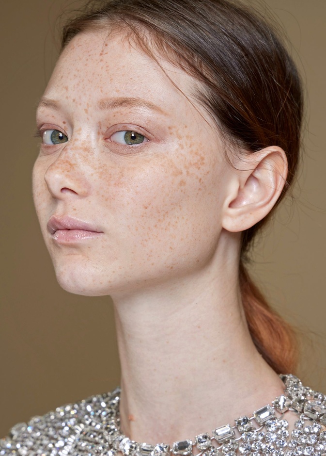 النمش ..أسبابه وأهم حيل جمالية لإخفائه في شهر رمضان