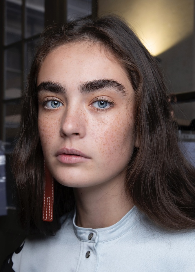 هل يمكنك تقليل ظهور النمش من دون التقنيات الجراحية؟ إليك بعض الحيل