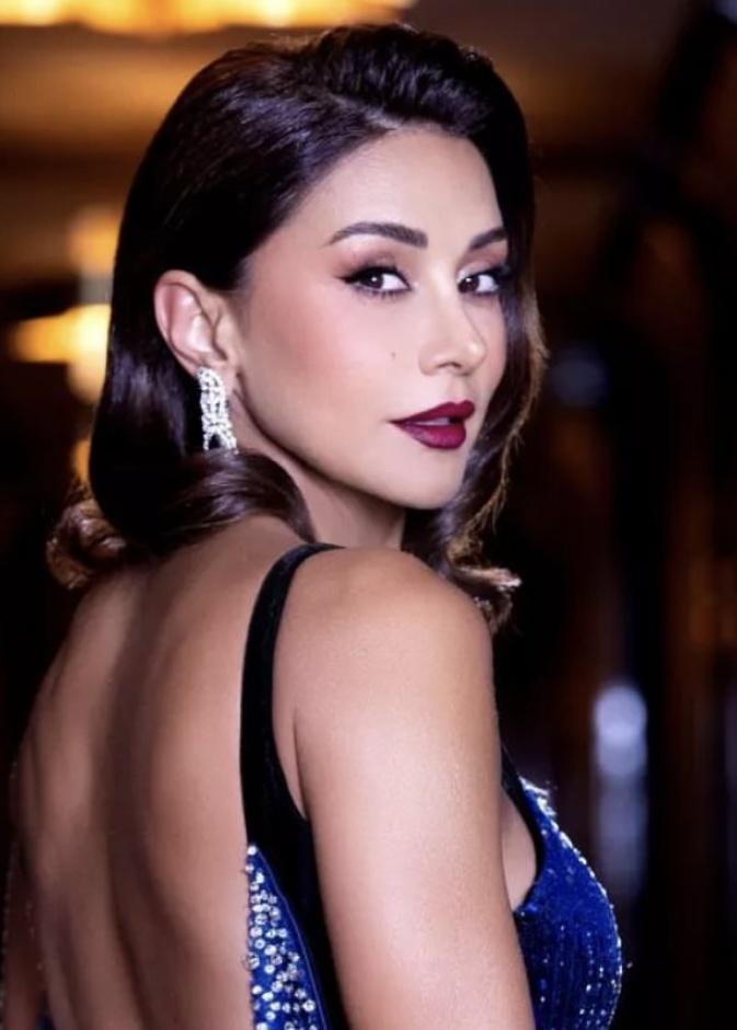 عملية تجميل للأنف خضعت لها كاريس بشار