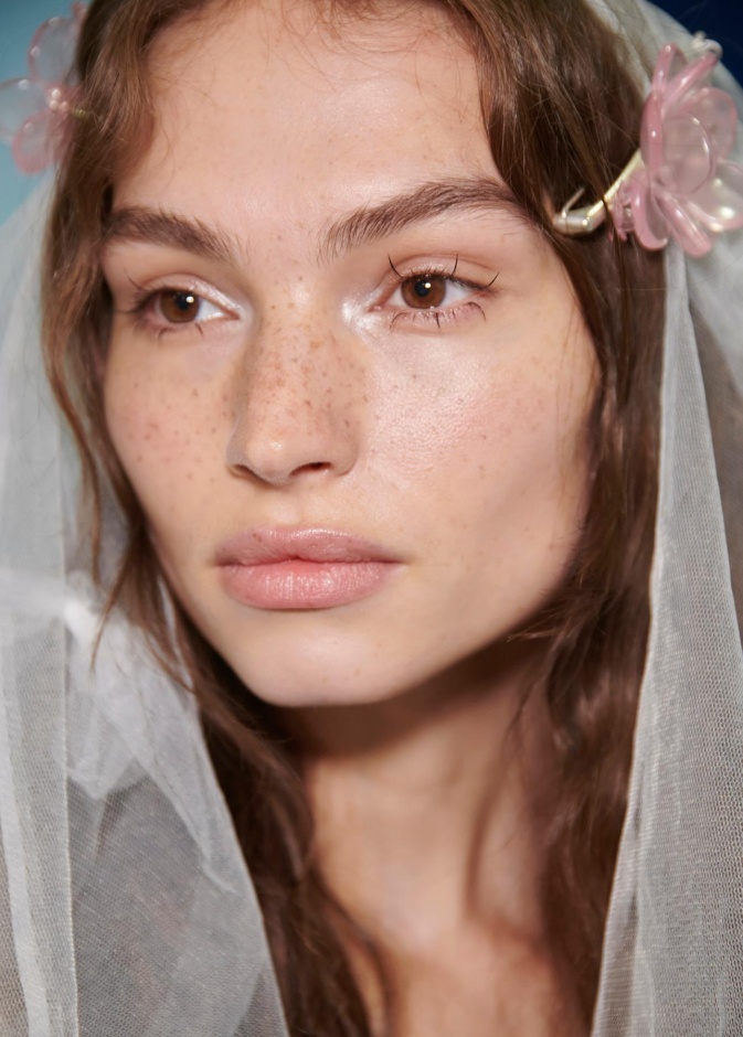 سيطري على النمش الصيفي وتخلصي منه دون مواد كيميائية