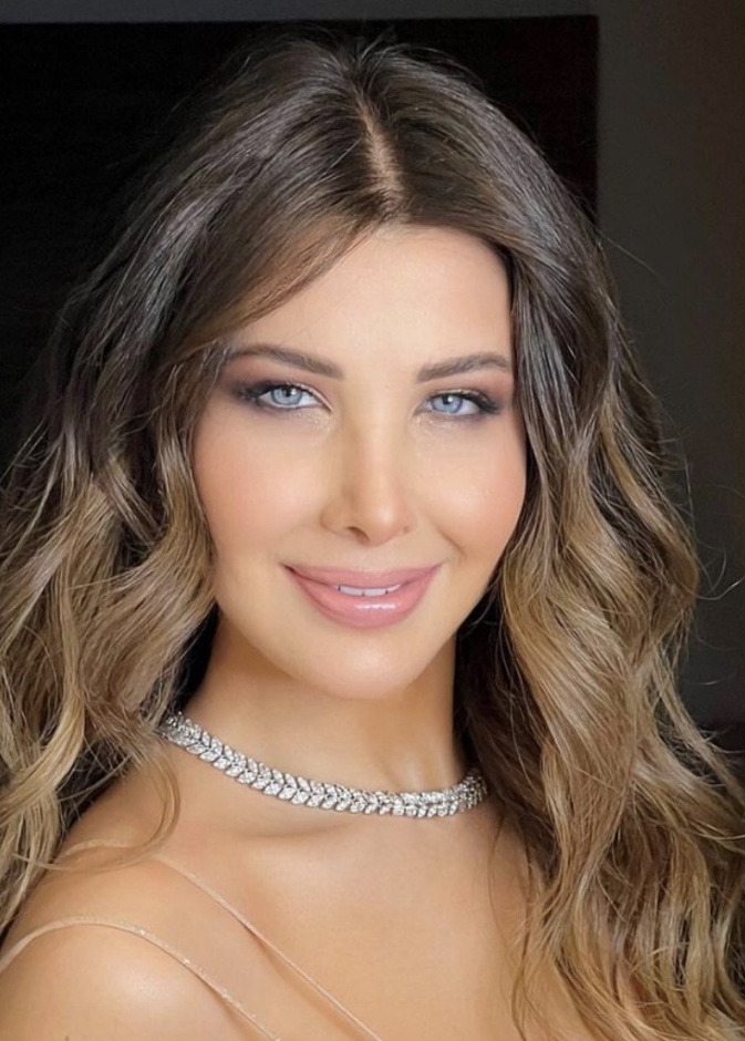 الفصل المناسب لإجراء عملية تجميل الأنف - صورة من انستجرام نانسي عجرم