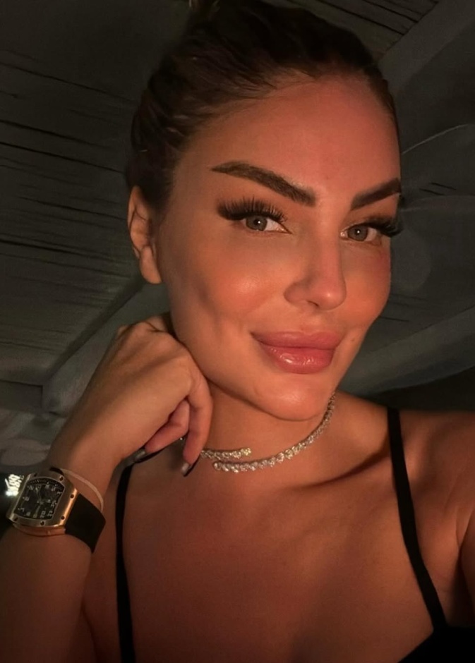 عملية رفع الحواجب بتقنية 3Q  - صورة من حساب ساندرا رزق من انستجرام