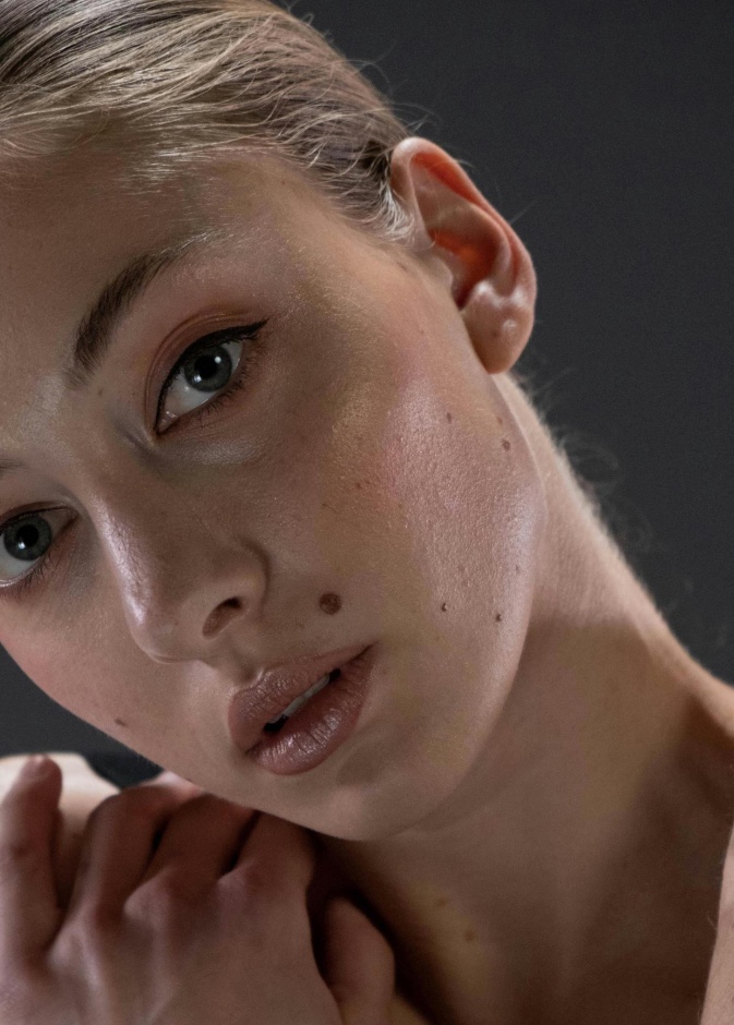 تقنيات تجميلية لإزالة شامات الجسم والوجه