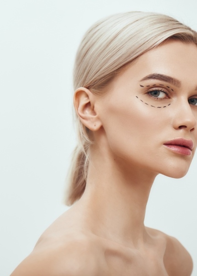 نتيجة حقن الفيلر تحت العين 