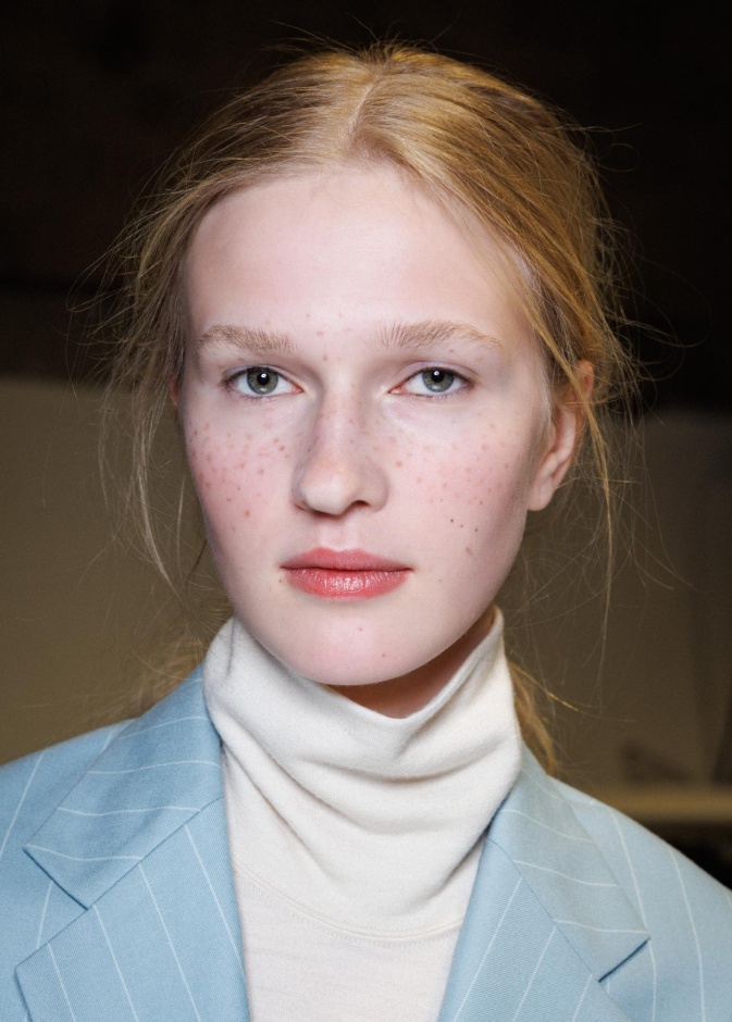 حلول مبتكرة لإزالة النمش وإعادة إشراقة الوجه الطبيعية