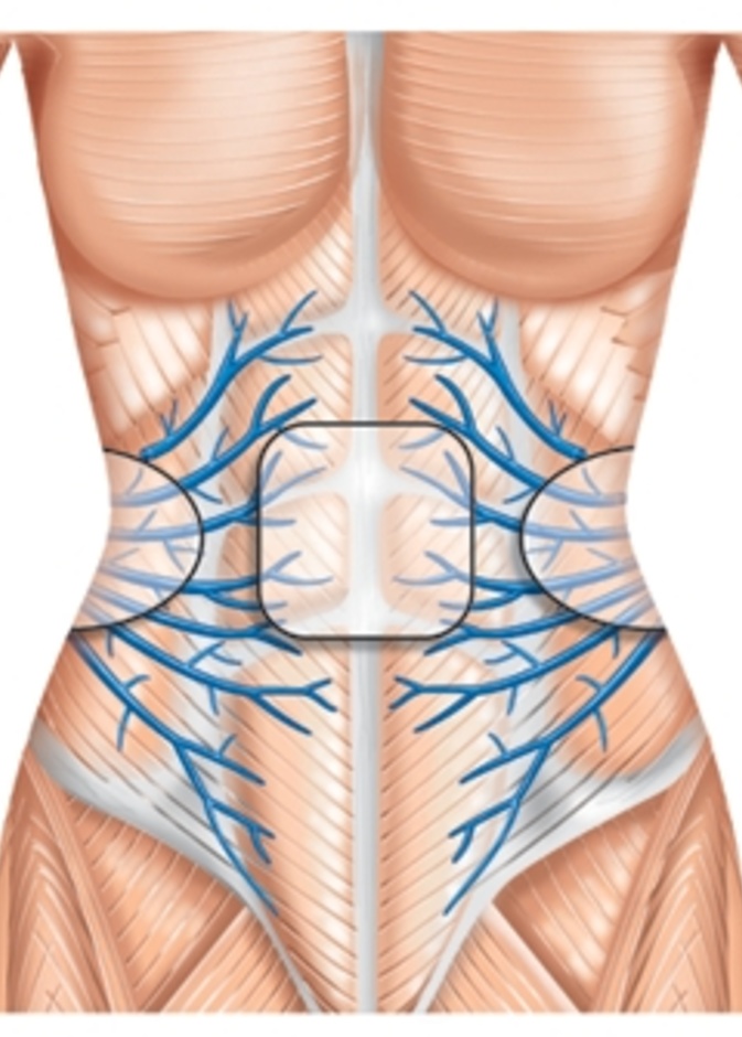 إحصلي على بطن مشدود وخصر نحيف مع جهاز "سلندرتون" 