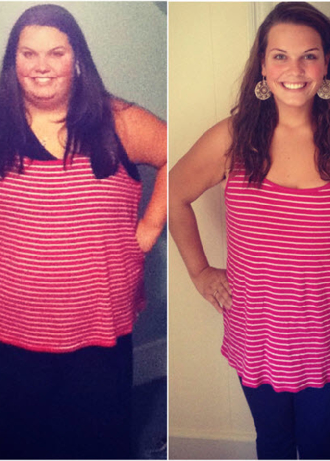 صورة توضح ماري قبل وبعد العملية الجراحية التي افقدتها نصف وزنها