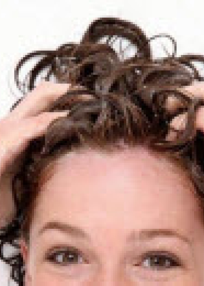 الخل يقضي على  قشرة الشعر