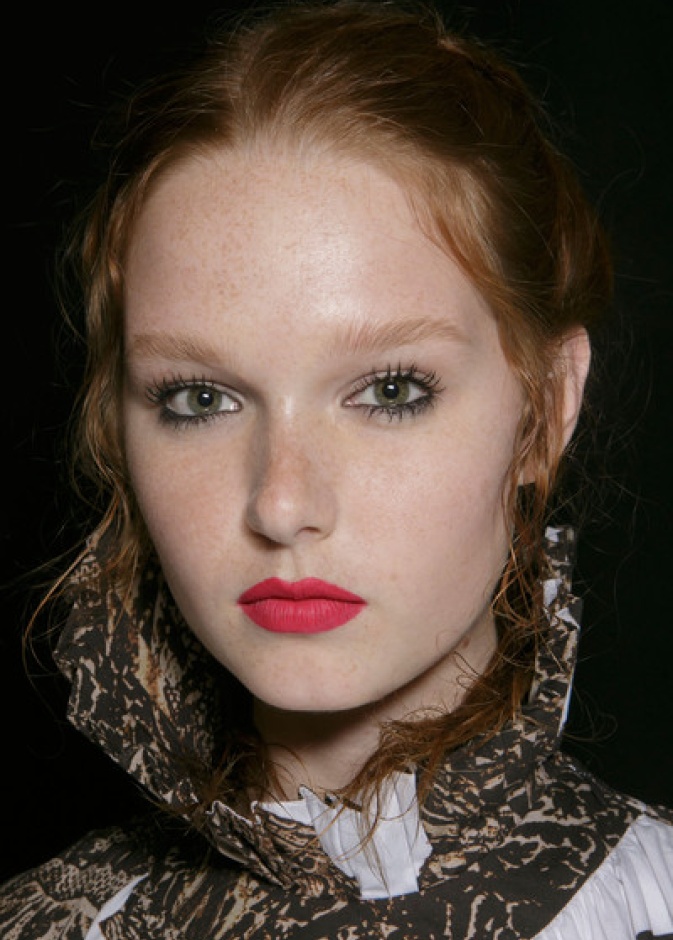 الحمرة البارزة والناشفة أيضاً حاضرة