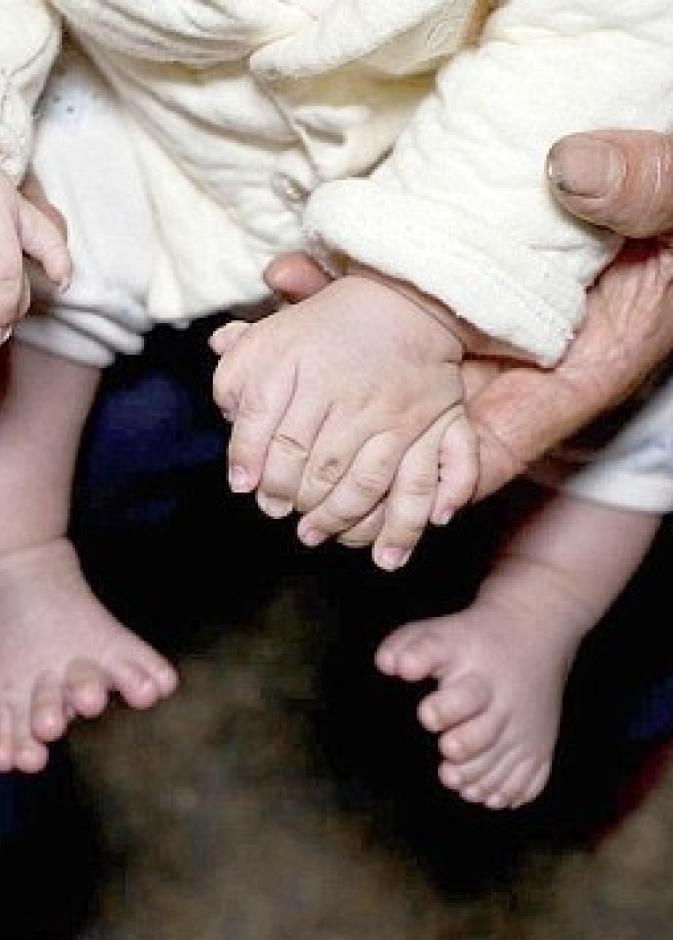 طفلا صينيا ولد بـ 16 اصبعا على القدمين و15 اخرى على اليدين
