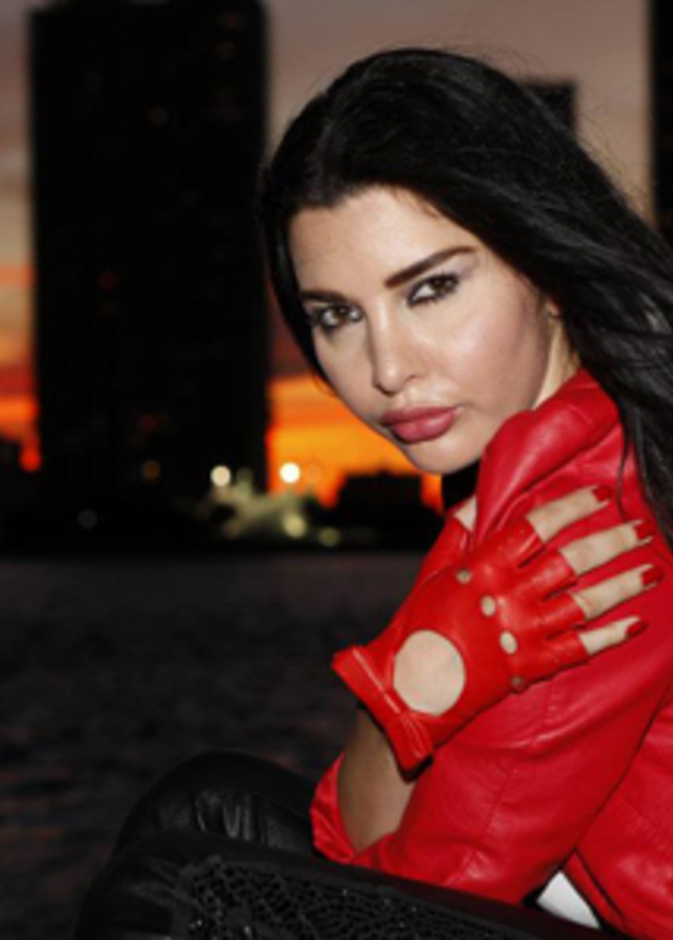 لاميتا فرنجيه بعد عمليات التجميل