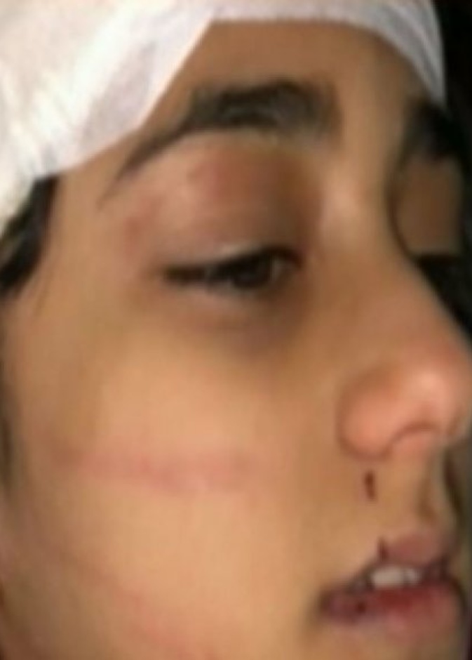 والد مايا بخش يروي تفاصيل إصابة ابنته في مزرعة ذهبان