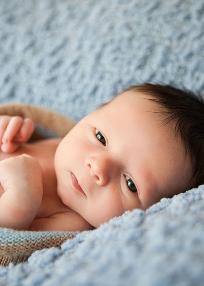 علامات جلدية تظهر على جلد المولود الجديد