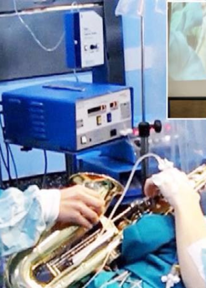 بالفيديو مريض يعزف على آلة موسيقية أثناء إزالة ورم من دماغه