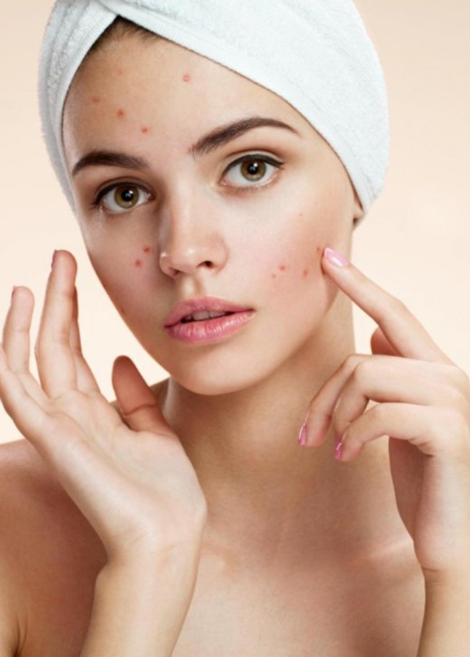 تهيج الجلد والبقع الحمراء به من أعراض الصدفية