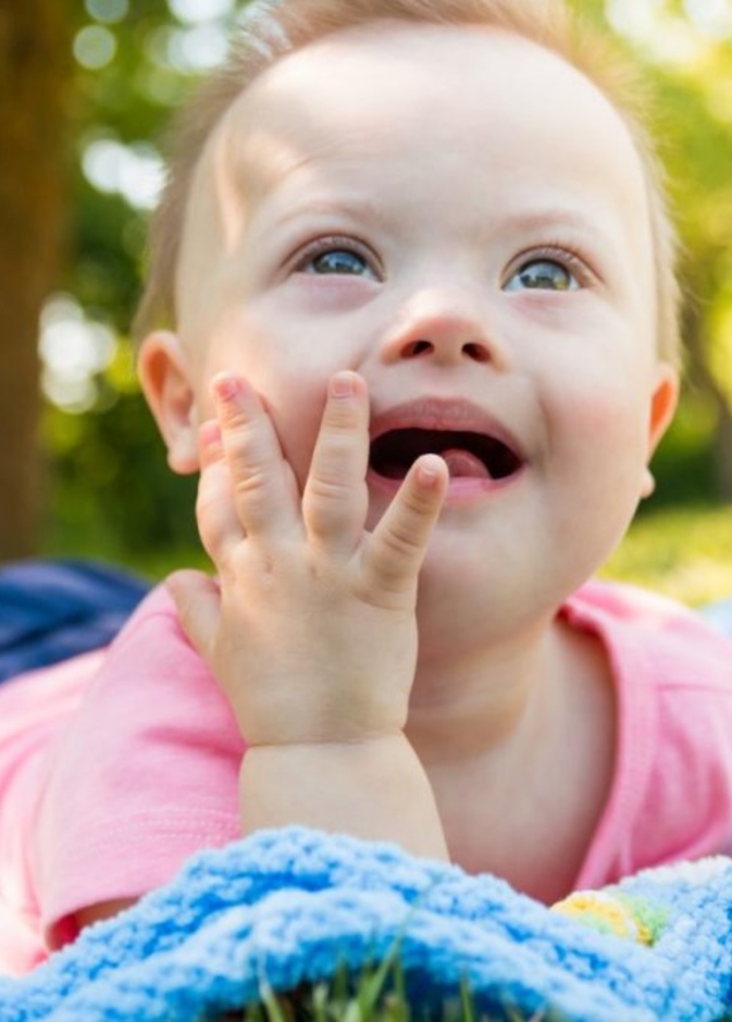 صفات تؤكد ان الطفل منغولي