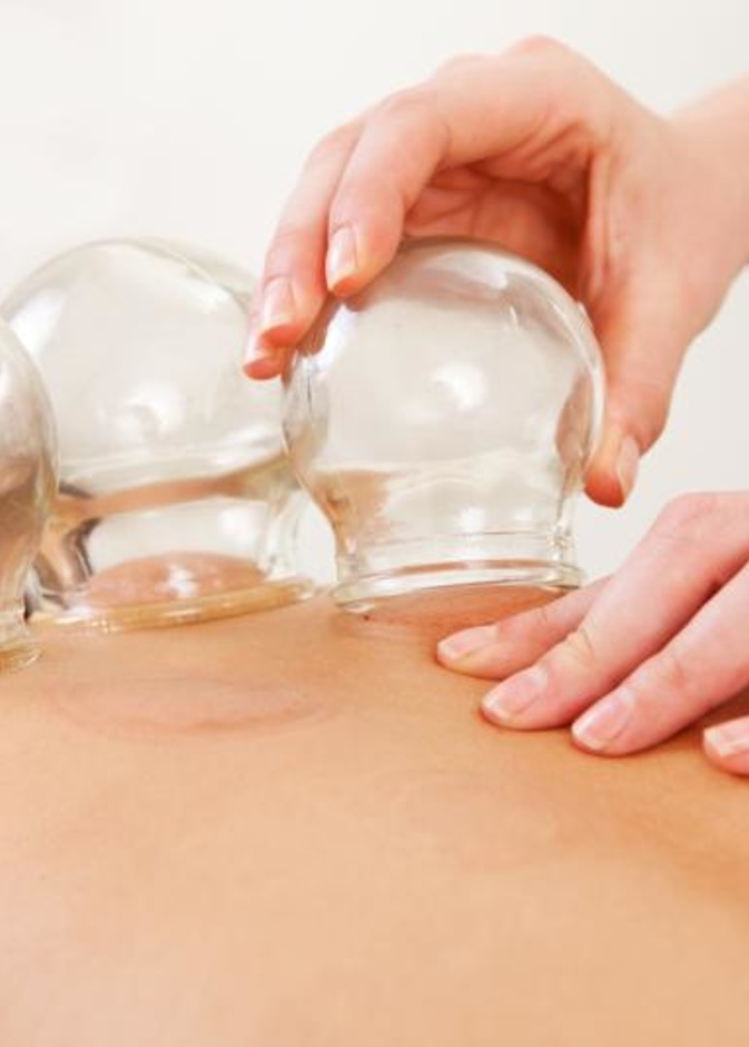 فوائد الحجامة للرجال