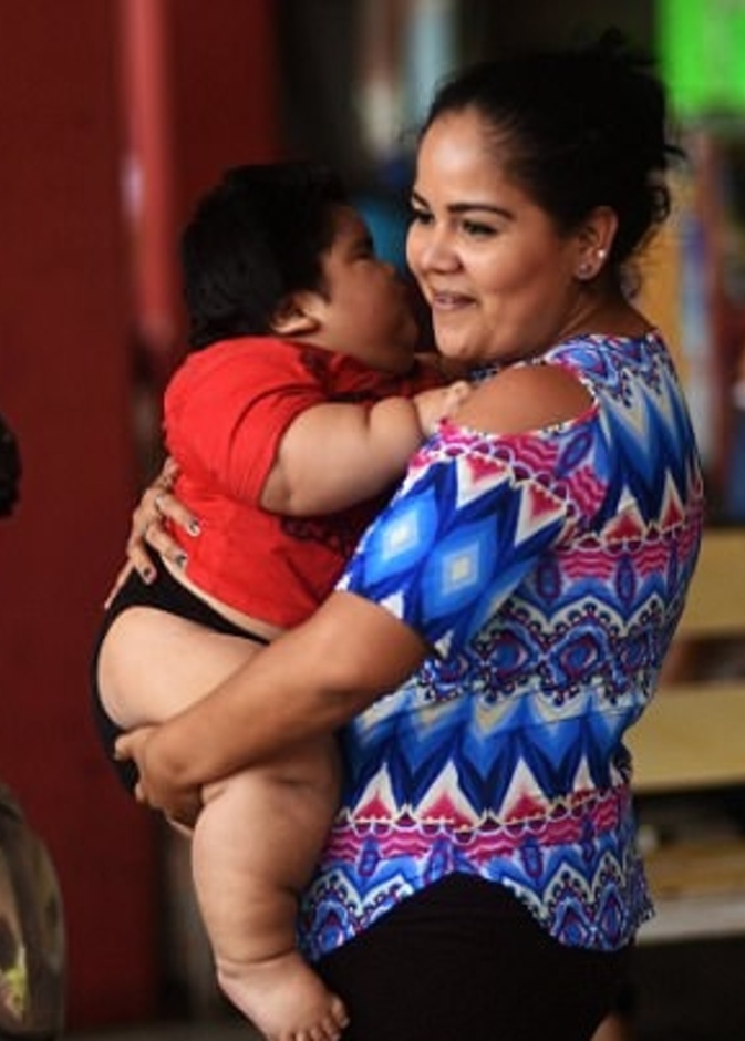 أم أسمن طفل في العالم تتحدث عن حالة طفلها