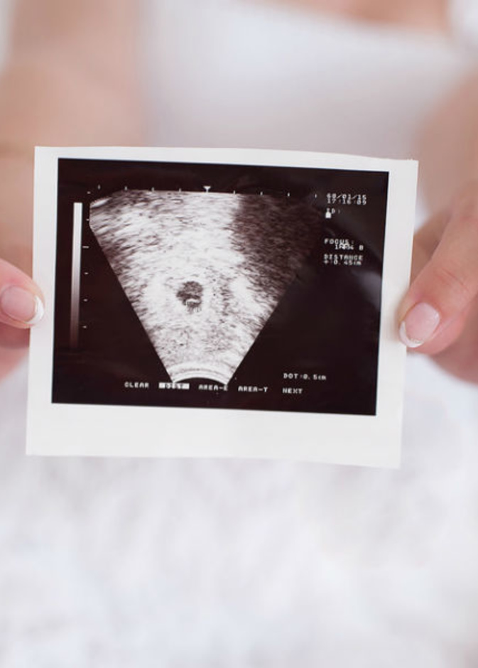 يمكن قياس نبض الجنين من الاسبوع 8 من الحمل