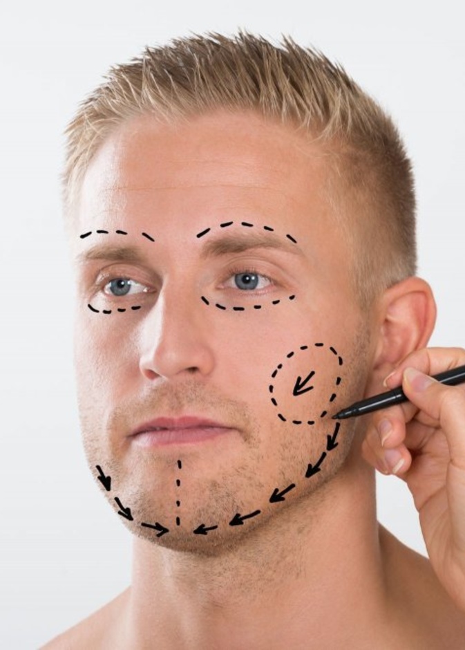 علاج اضطراب التشوه الجسمي لدي الرجال