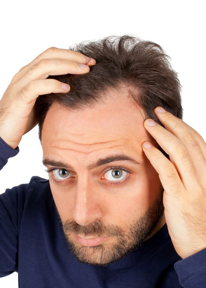 زراعة الشعر الطريقة العلاجية التي غالبا ما يلجأ إليها من يعانون من الصلع