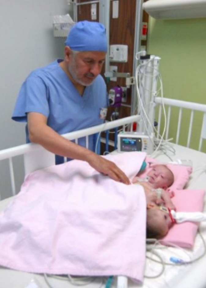 فرح قد تفقد حياتها في عملية فصلهن