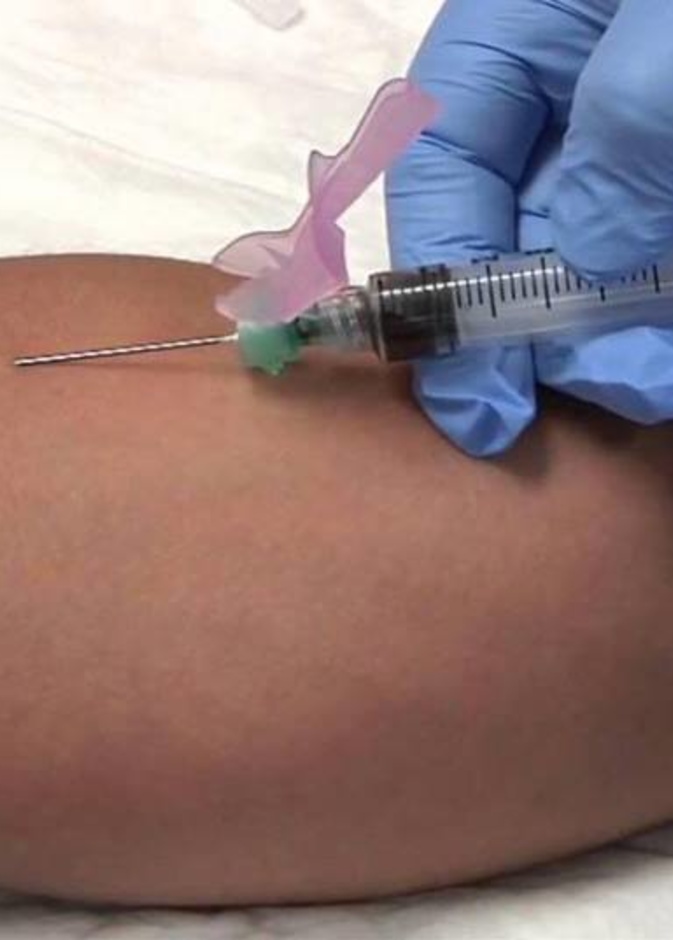 حقن الوريد لمريض السرطان هل تبطل الصيام