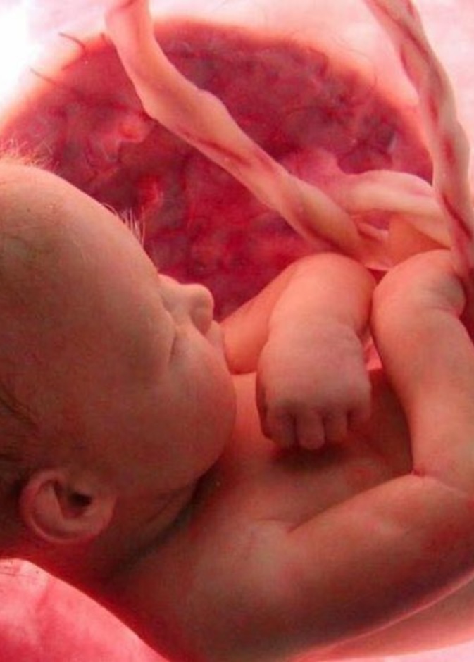 موت الجنين في رحم الام .. ما هي اسبابه ومخاطره