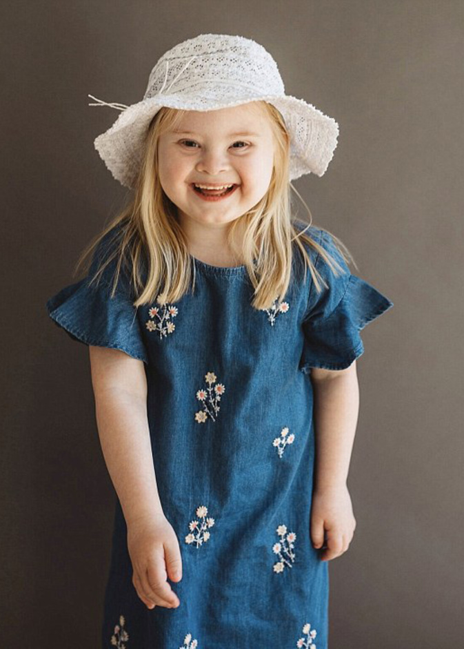 طفلة مصابة بمتلازمة داوين تصبح عارضة أزياء شهيرة