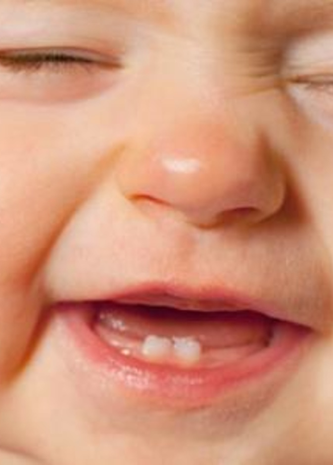 خطورة إهمال الأمهات لأسنان الأطفال 