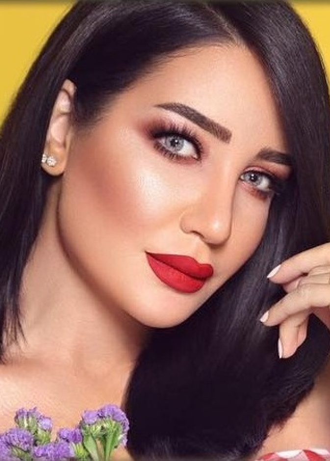 أمل العنبري قبل ازالة حقن الفيلر من وجهها