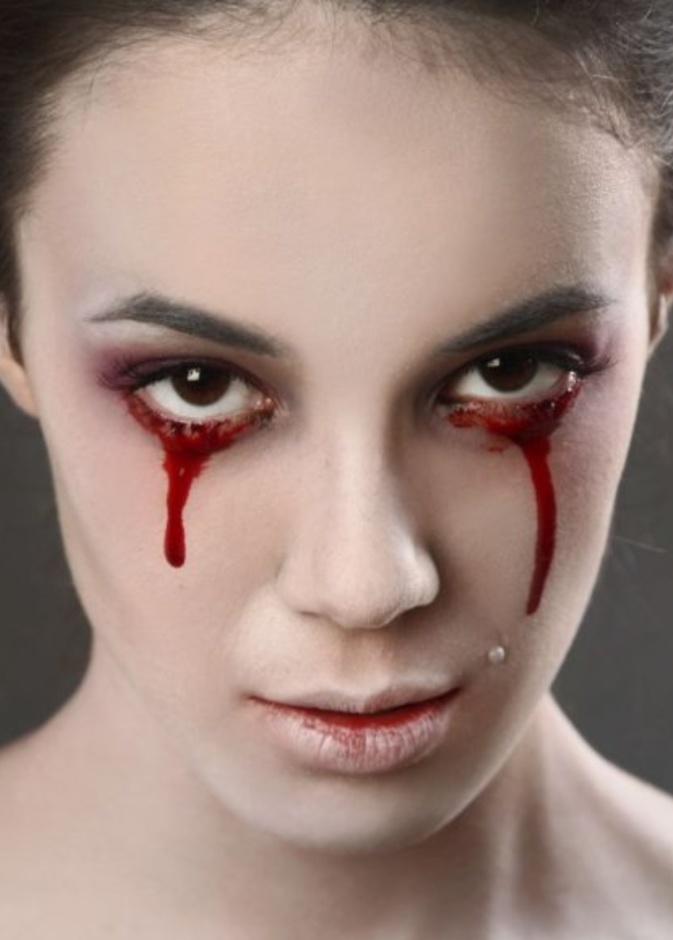 حالة طبية شديدة الندرة