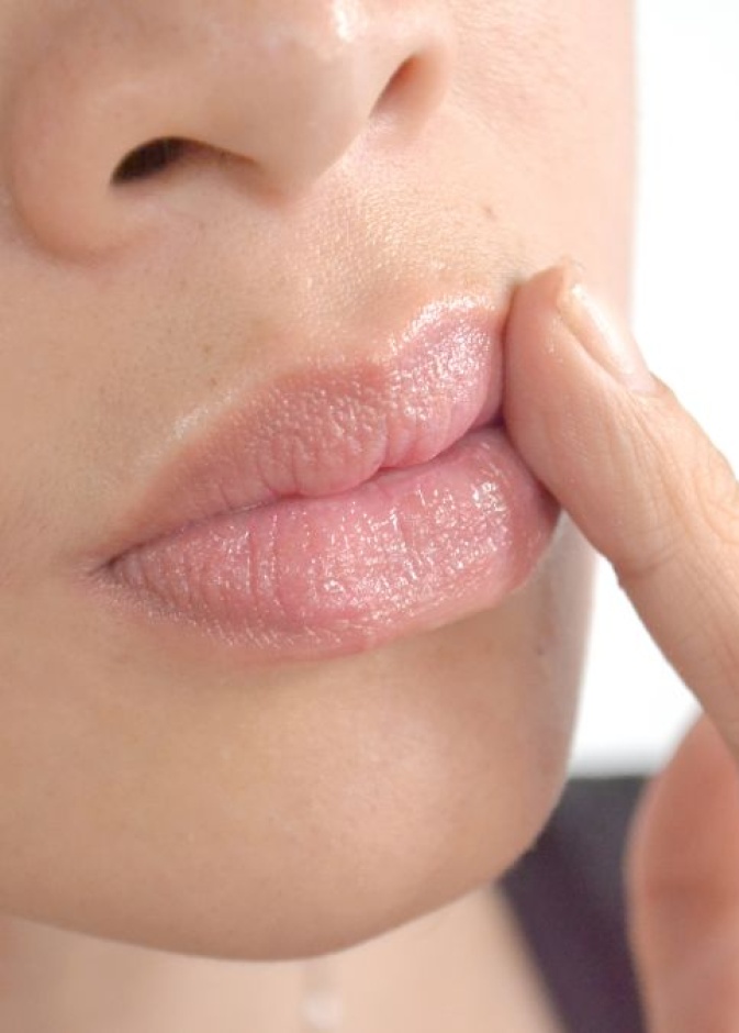 أسباب تشققات زوايا فم العروس وطرق علاجها