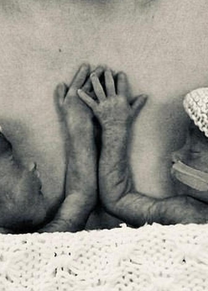 الأطباء توقعوا وفاة التوأم خلال ساعات